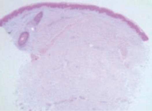 未注射切片示意圖